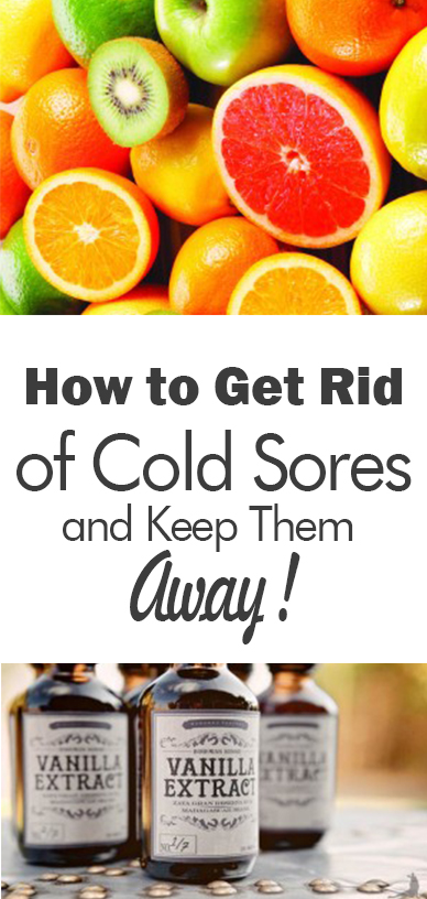How to Get Rid of Cold Sores and Keep Them Away!