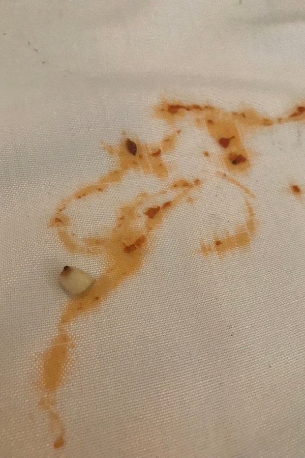 Easy Ways To Say Goodbye To Gravy Stains | 101 Days of Organization